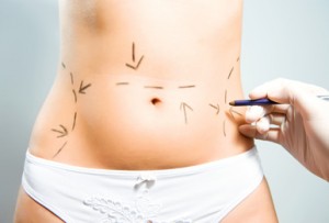 LIPO