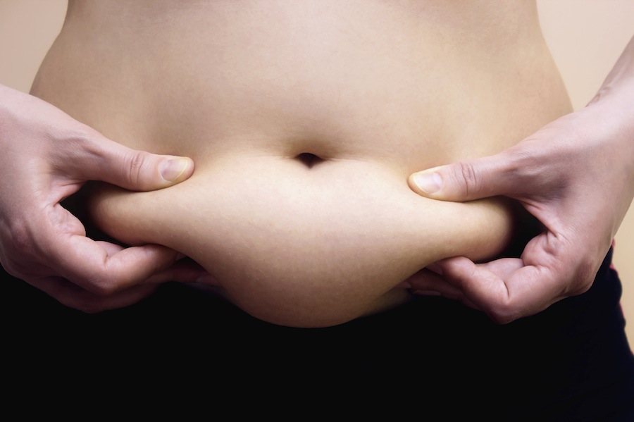 abdominoplastia