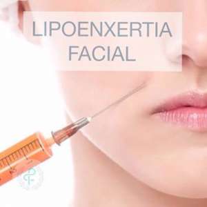 lipoenxertia facial