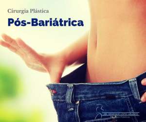 Pós bariátrica