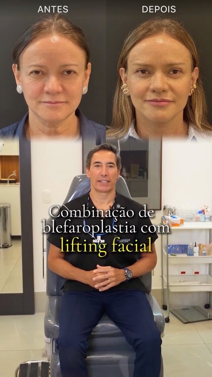 Não adianta rejuvenescer o olhar se o contorno do rosto continua entregando a idade.
