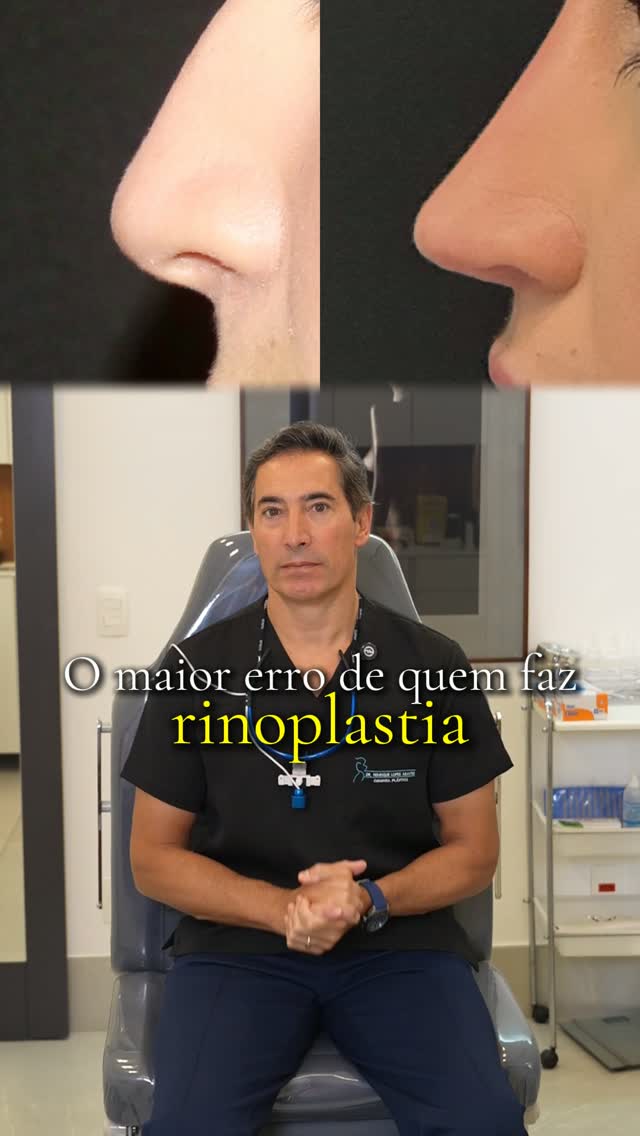 O maior erro de quem faz rinoplastia é julgar o resultado com apenas 2 meses.