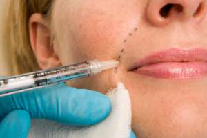 Woman getting injection in face